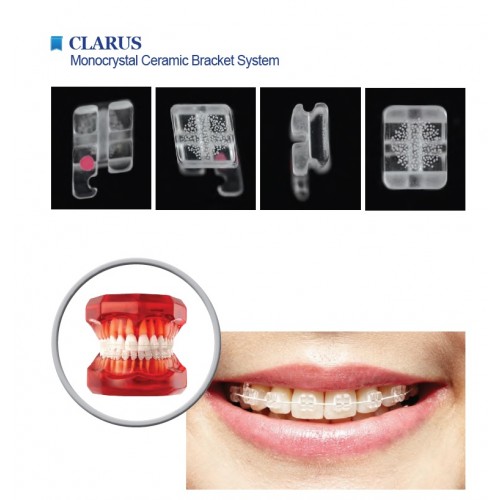 Zamki ceramiczne CLARUS