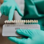 Ile kosztuje wybielanie zębów u dentysty w 2025 roku? Dentysta porównuje odcień zębów za pomocą kolorn