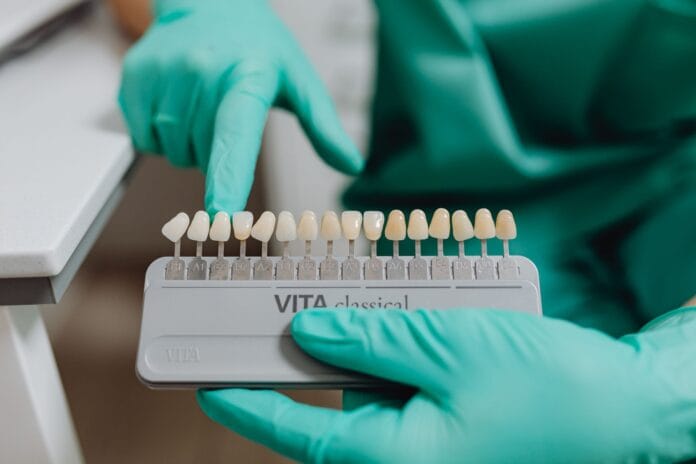 Dentysta porównuje odcień zębów za pomocą kolorn